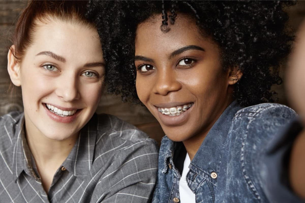 Seacoast Braces / Miller Orthodontics Becomes Sole Provider of Dynaflex Norris Passive Self-Ligating Brackets in Dover and Exeter, NH